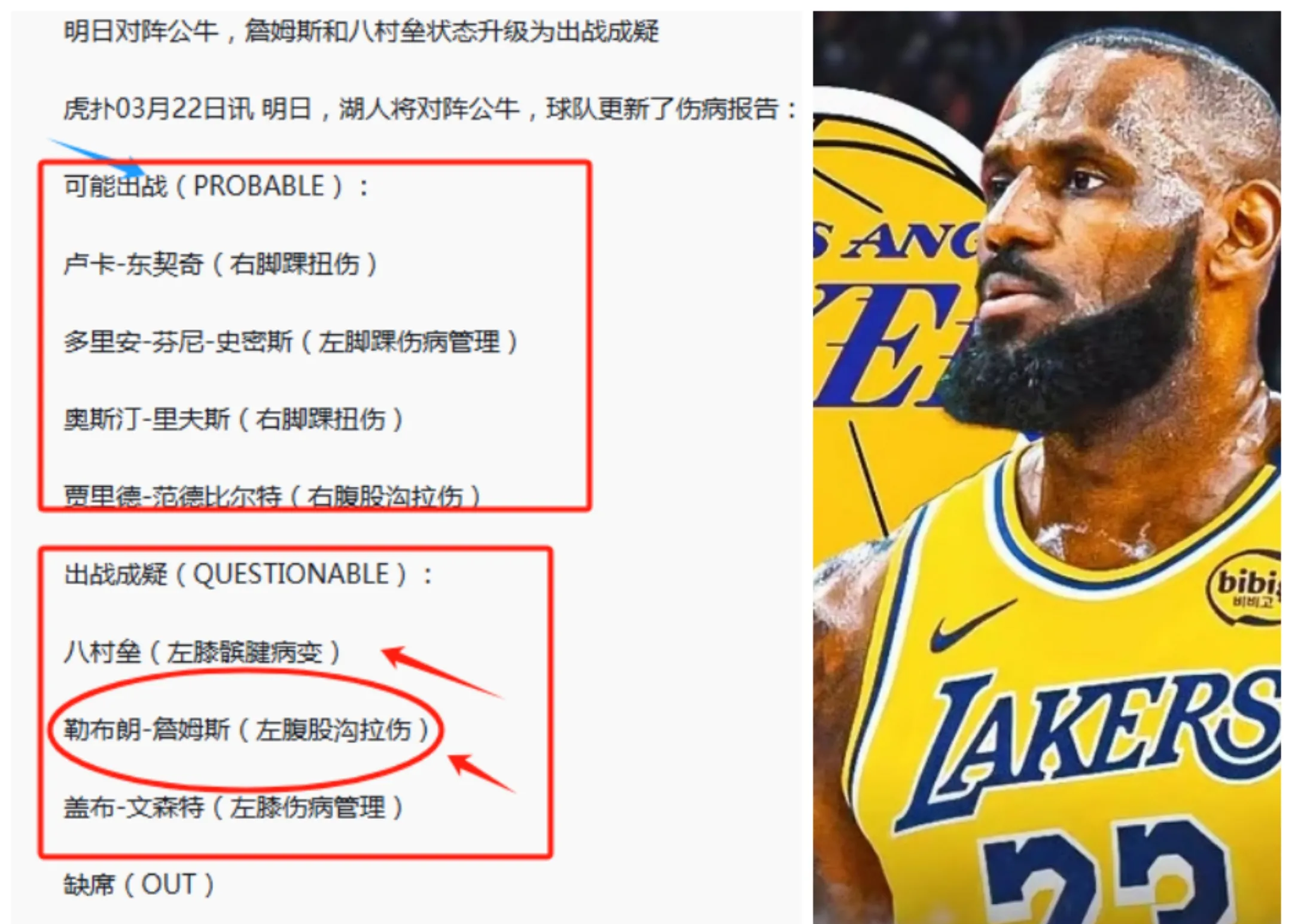 卢湾詹姆斯赛后神秘缺席，引发粉丝团体关注的简单介绍